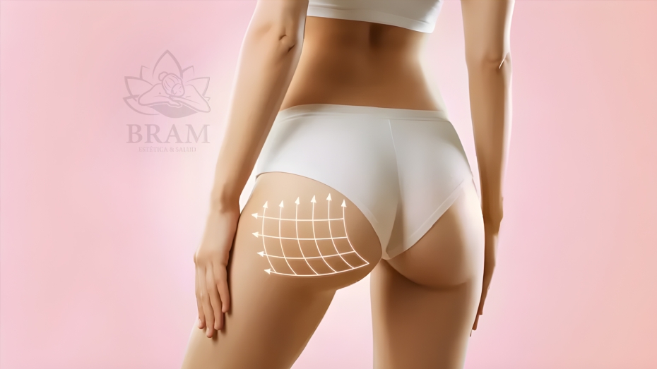 Dile adiós a la celulitis y realza tus glúteos con nuestro tratamiento Anticelulítico + Levanta Glúteos. Este servicio combina técnicas efectivas para mejorar la apariencia de tu piel y esculpir tu figura. Elige el paquete que mejor se adapte a ti y comienza a notar la diferencia:

6 sesiones	$80.000
12 sesiones	$140.000

-Ondas Rusas
-Radiofrecuencia
-Masaje Manual
-Maderoterapia